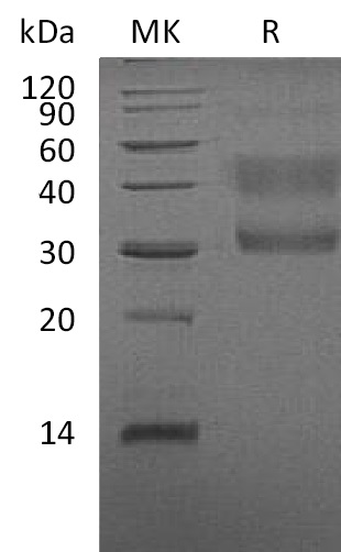 Human HGF R +SDS-PAGE-3.jpg